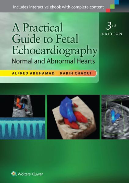 Cover for Alfred Z. Abuhamad · A Practical Guide to Fetal Echocardiography: Normal and Abnormal Hearts (Hardcover Book) (2015)