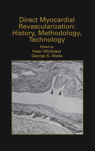 Cover for Peter Whittaker · Direct Myocardial Revascularization: History, Methodology, Technology - Developments in Cardiovascular Medicine (Paperback Book) [Softcover reprint of the original 1st ed. 1999 edition] (2012)