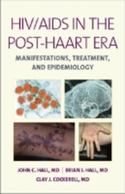 Aids in the 21st Century: Treatment, Prevention and Epidemiology - John Hall - Books - PMPH-USA Limited - 9781607951056 - September 16, 2011