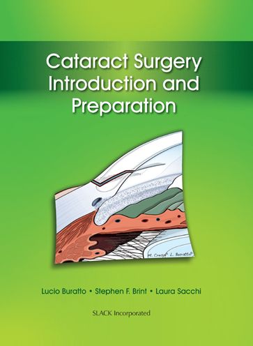 Cover for Lucio Buratto · Cataract Surgery: Introduction and Preparation (Hardcover Book) (2014)