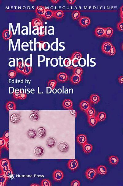 Cover for Denise L Doolan · Malaria Methods and Protocols - Methods in Molecular Medicine (Paperback Book) [Softcover reprint of hardcover 1st ed. 2002 edition] (2010)