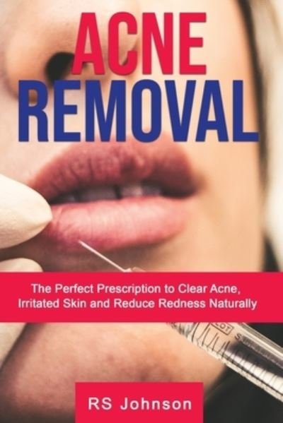 Cover for Rs Johnson · Acne Removal: The Perfect Prescription to clear Acne, Irritated skin and reduce redness naturally (Paperback Bog) (2021)