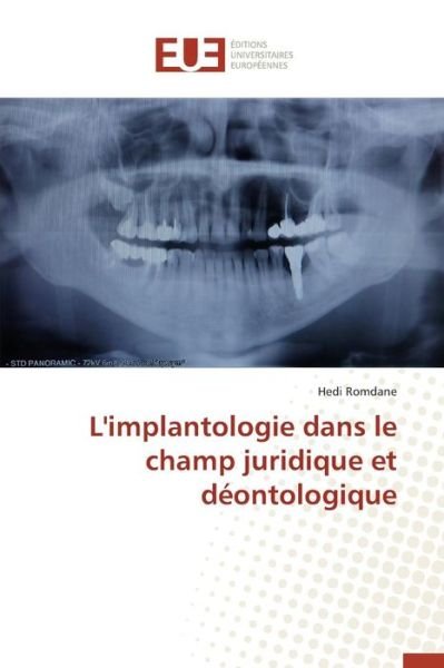 Cover for Romdane Hedi · L'implantologie Dans Le Champ Juridique et Deontologique (Paperback Book) (2018)