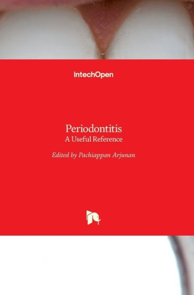 Cover for Pachiappan Arjunan · Periodontitis: A Useful Reference (Hardcover bog) (2017)