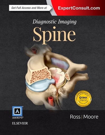 Diagnostic Imaging: Spine - Ross - Kirjat - Elsevier - Health Sciences Division - 9780323377058 - tiistai 23. kesäkuuta 2015