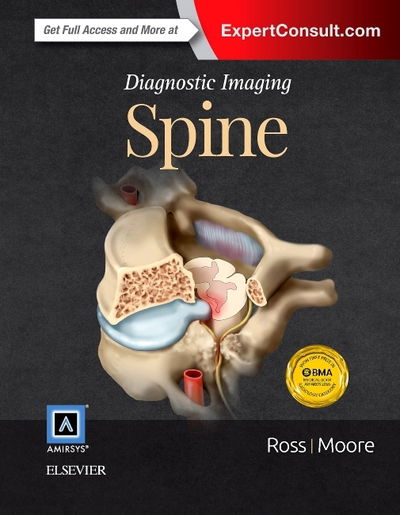 Diagnostic Imaging: Spine - Ross - Boeken - Elsevier - Health Sciences Division - 9780323377058 - 23 juni 2015