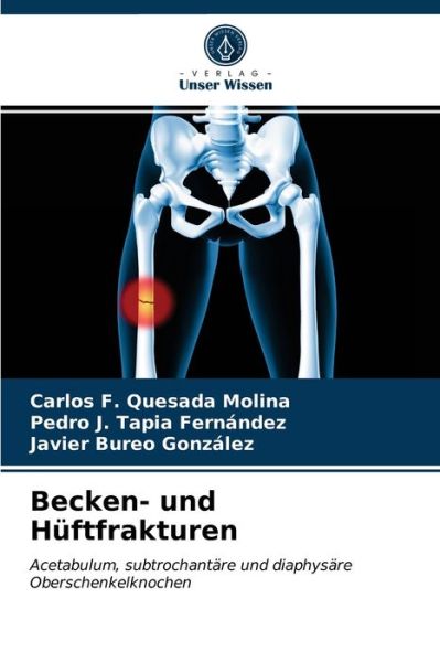 Cover for Carlos F Quesada Molina · Becken- und Huftfrakturen (Paperback Book) (2021)
