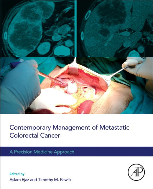 Cover for Timothy M. Pawlik · Contemporary Management of Metastatic Colorectal Cancer: A Precision Medicine Approach (Paperback Book) (2022)