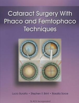 Cover for Lucio Buratto · Cataract Surgery With Phaco and Femtophaco Techniques (Hardcover Book) (2014)