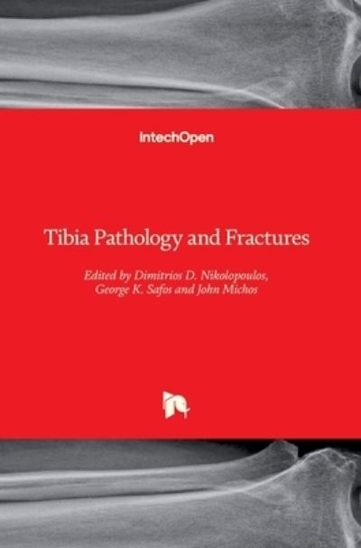 Cover for Dimitrios D. Nikolopoulos · Tibia Pathology and Fractures (Hardcover Book) (2020)
