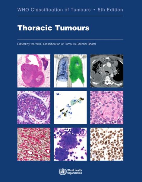 Thoracic tumours - International Agency for Research on Cancer - Książki - IARC - 9789283245063 - 21 kwietnia 2021