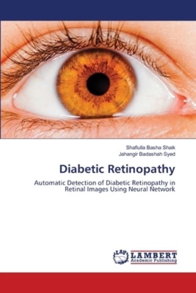 Diabetic Retinopathy - Shaik - Outro - - 9786203306064 - 29 de janeiro de 2021