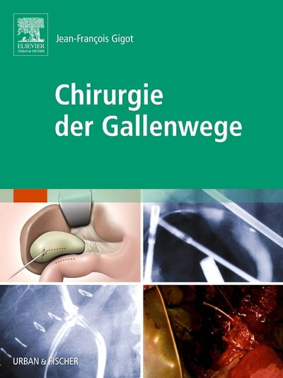 Cover for Gigot · Chirurgie der Gallenwege (Book)
