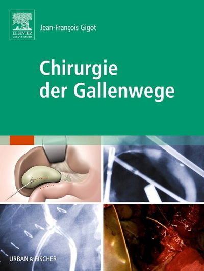 Chirurgie der Gallenwege - Gigot - Bücher -  - 9783437313066 - 