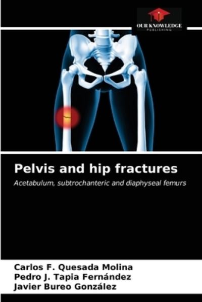 Cover for Carlos F Quesada Molina · Pelvis and hip fractures (Paperback Book) (2021)