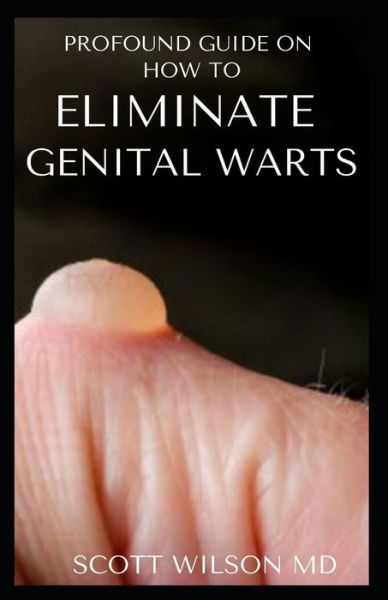 Profound Guide to Eliminate Genital Warts - Scott Wilson - Books - Independently Published - 9798554339066 - October 27, 2020