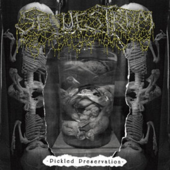 Cover for Sequestrum · Pickled Preservation (CD) (2023)