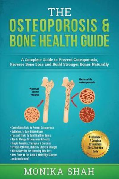 Osteoporosis - Monika Shah - Books - Createspace Independent Publishing Platf - 9781540619068 - November 25, 2016