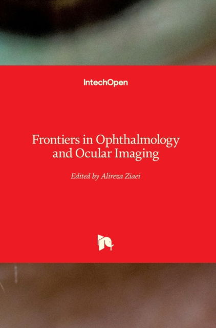 Cover for Alireza Ziaei · Frontiers in Ophthalmology and Ocular Imaging (Hardcover Book) (2019)