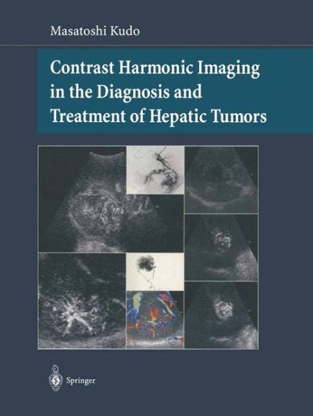 Cover for Masatoshi Kudo · Contrast Harmonic Imaging in the Diagnosis and Treatment of Hepatic Tumors (Paperback Book) [Softcover reprint of the original 1st ed. 2003 edition] (2013)