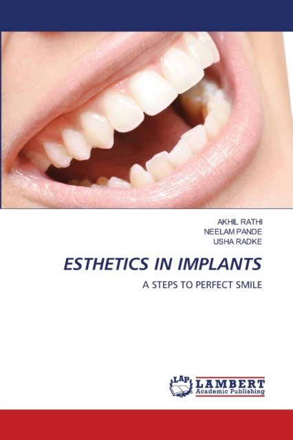 Cover for Akhil Rathi · Esthetics in Implants (Pocketbok) (2020)