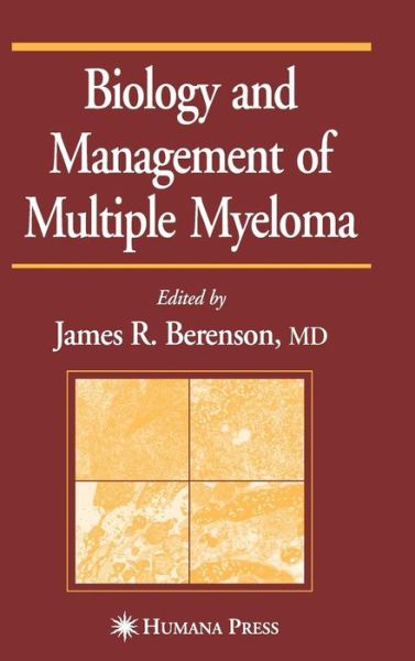 Biology and Management of Multiple Myeloma - James Berenson - Książki - Humana Press - 9780896037069 - 14 maja 2004