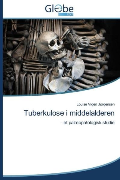 Cover for Jorgensen Louise Vigen · Tuberkulose I Middelalderen (Paperback Book) [Danish edition] (2014)