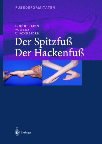 Cover for Leonhard Doderlein · Fussdeformitaten: Der Spitzfuss / Der Hackenfuss (Paperback Book) (2012)