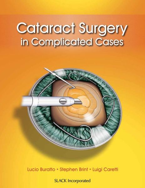 Cover for Lucio Buratto · Cataract Surgery in Complicated Cases (Hardcover Book) (2013)