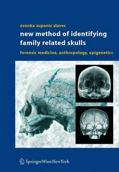 Cover for Zvonka Zupanic Slavec · New Method of Identifying Family Related Skulls: Forensic Medicine, Anthropology, Epigenetics (Paperback Bog) [Softcover reprint of the original 1st ed. 2004 edition] (2012)