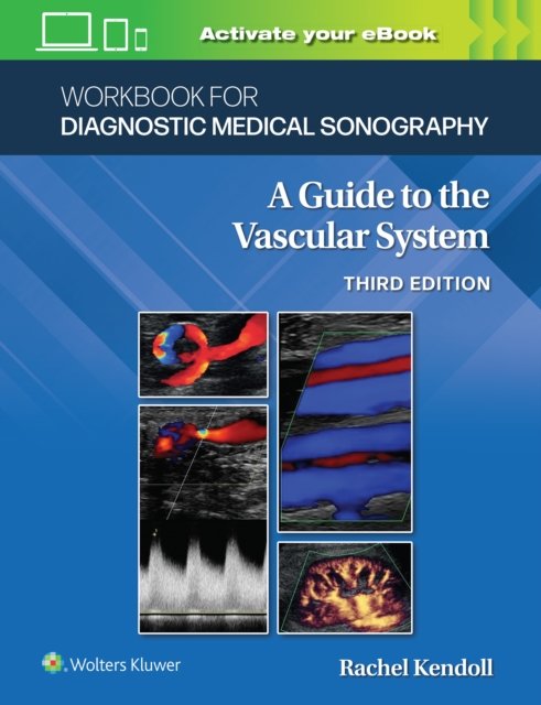 Cover for Kupinski, Ann Marie, PhD, RVT · Workbook for Diagnostic Medical Sonography: The Vascular Systems - Diagnostic Medical Sonography Series (Paperback Book) (2022)