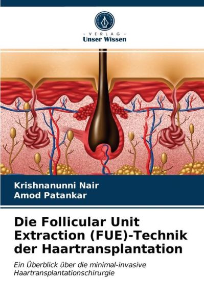 Cover for Krishnanunni Nair · Die Follicular Unit Extraction (FUE)-Technik der Haartransplantation (Paperback Book) (2021)