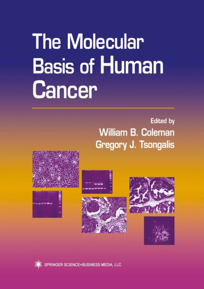 Cover for The Molecular Basis of Human Cancer (Paperback Book) [Softcover reprint of the original 1st ed. 2002 edition] (2010)