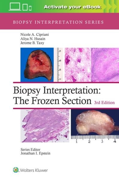 Cover for Cipriani, Nicole A., MD · Biopsy Interpretation: The Frozen Section: Print + eBook with Multimedia - Biopsy Interpretation Series (Hardcover Book) (2022)