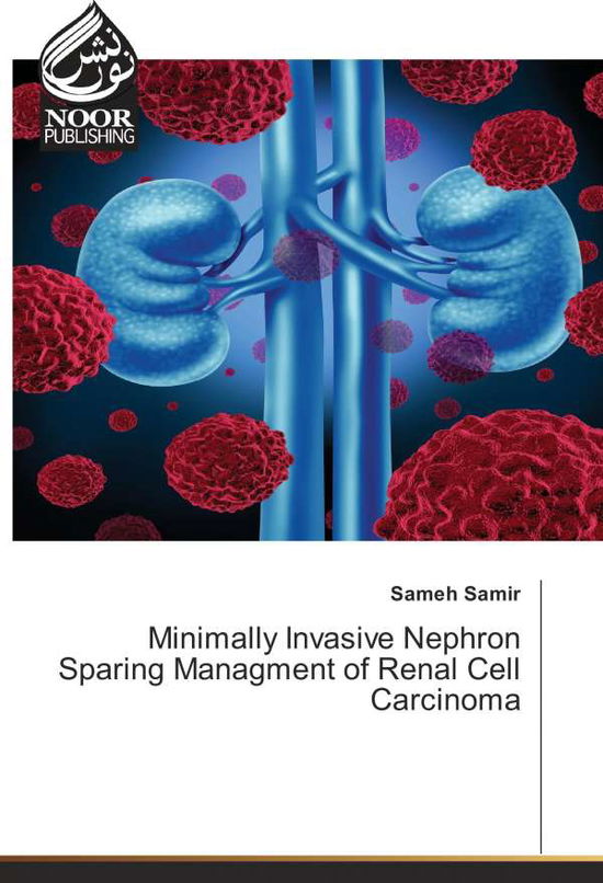 Cover for Samir · Minimally Invasive Nephron Sparin (Book)