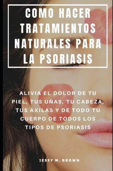 Cover for Jessy M Brown · Como Hacer Tratamientos Naturales Para La Psoriasis (Taschenbuch) (2019)