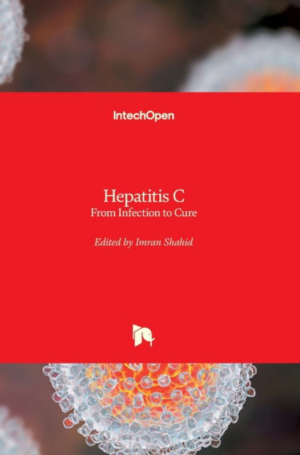 Cover for Imran Shahid · Hepatitis C (Hardcover Book) (2018)