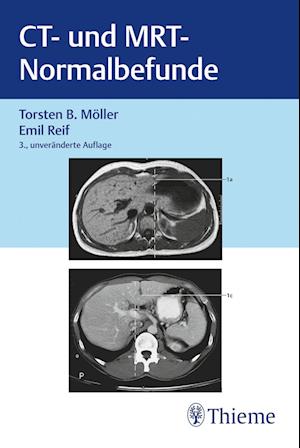 Cover for Möller; Reif · Ct Und Mrt Normalbefunde (Book)