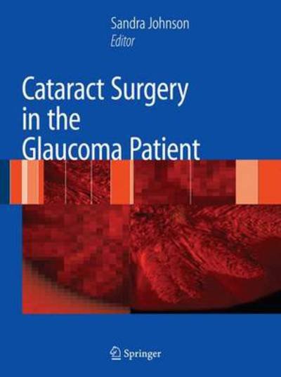 Cataract Surgery in the Glaucoma Patient - Sandra Johnson - Libros - Springer-Verlag New York Inc. - 9780387094076 - 28 de septiembre de 2009