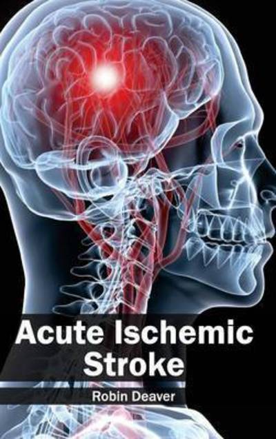 Cover for Robin Deaver · Acute Ischemic Stroke (Hardcover Book) (2015)