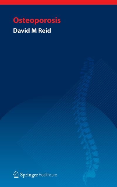 Cover for David Reid · Handbook of Osteoporosis (Paperback Book) [2011 edition] (2011)