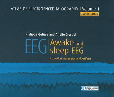 Cover for Dr Philippe Gelisse · Atlas of Electroencephalography: Awake and sleep EEG (Hardcover Book) (2016)