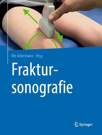 Cover for Fraktursonografie (Book) (2019)