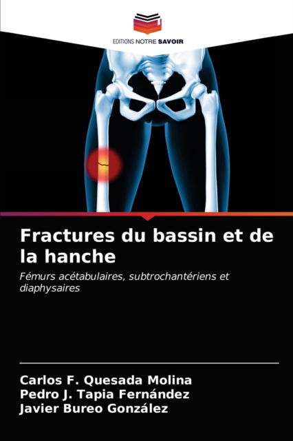 Cover for Carlos F Quesada Molina · Fractures du bassin et de la hanche (Paperback Book) (2021)