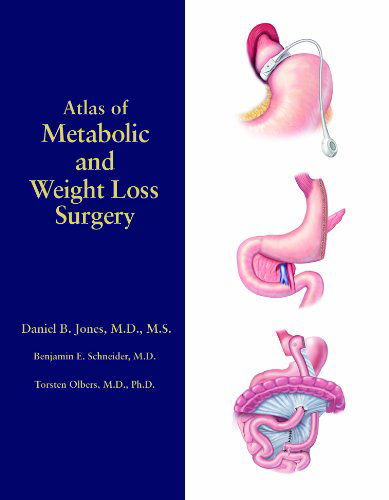 Cover for Phd · Atlas of Metabolic and Weight Loss Surgery (Hardcover bog) [1st edition] (2010)