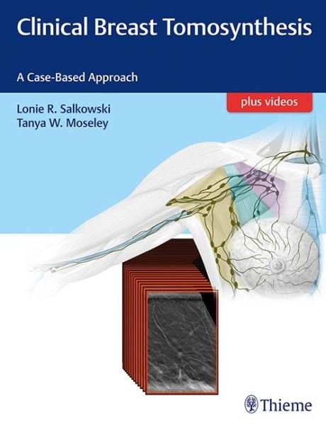 Clinical Breast Tomosynthesis: A Case-Based Approach - Lonie R. Salkowski - Boeken - Thieme Medical Publishers Inc - 9781626232082 - 7 september 2017