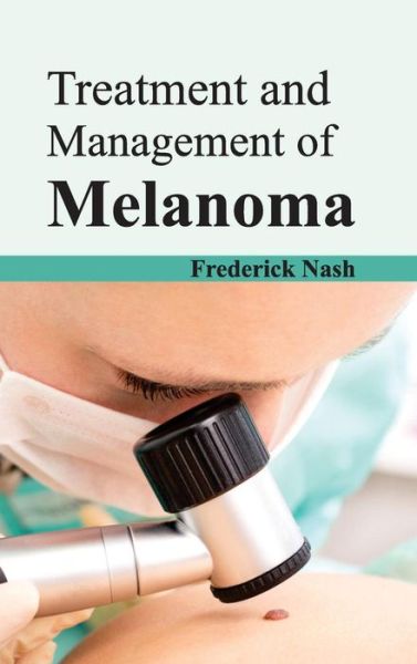 Cover for Frederick Nash · Treatment and Management of Melanoma (Hardcover Book) (2015)