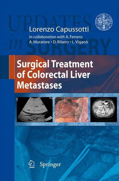 Cover for Lorenzo Capussotti · Surgical Treatment of Colorectal Liver Metastases - Updates in Surgery (Hardcover Book) [2011 edition] (2010)