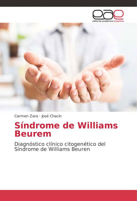 Síndrome de Williams Beurem - Zara - Bøger -  - 9786202098083 - 15. januar 2018