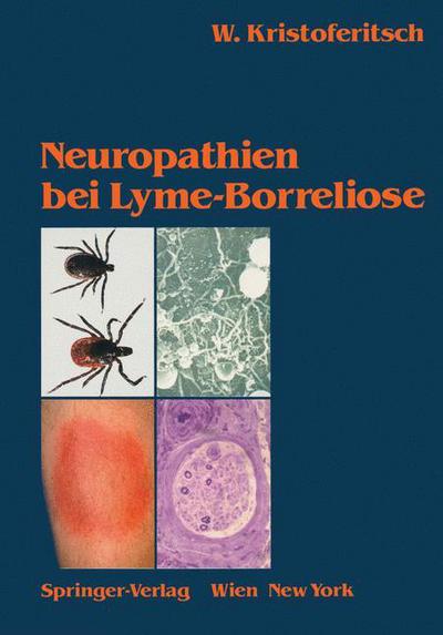 Cover for Wolfgang Kristoferitsch · Neuropathien Bei Lyme-Borreliose (Hardcover Book) [German edition] (1989)